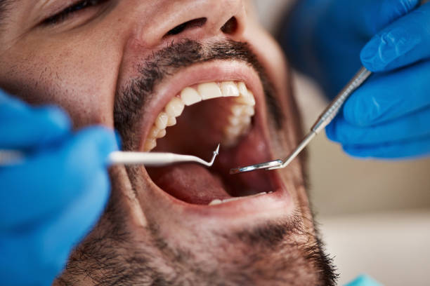 Best Emergency Treatment for Dental Infections or Abscesses in Union Grove, WI